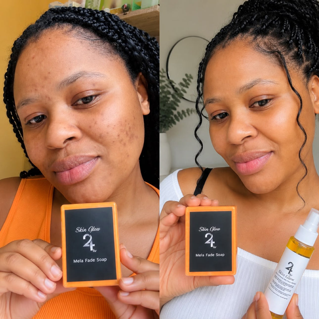 24-Hour Skin Glow MelaFade Soap + Vitamin C Oil